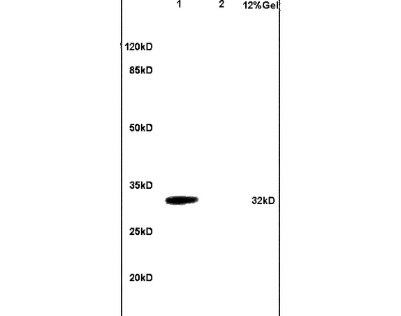 L1 mouse brain lysates L2 mouse heart lysates probed with Anti TNFRSF13B Polyclonal Antibody, Unconjugated (bs-2773R) at 1:200 in 4˚C. Followed by conjugation to secondary antibody (bs-0295G-HRP) at 1:3000 90min in 37˚C. Predicted band 32kD. Observed band size: 32kD