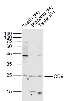 Lane 1: Mouse Testis lysates; Lane 2: Mouse Placenta lysates; Lane 3: Rat Testis lysates probed with CD9\/MRP-1 Polyclonal  Antibody, Unconjugated (bs-2489R) at 1:1000 dilution and 4˚C overnight incubation. Followed by conjugated secondary antibody incubation at 1:20000 for 60 min at 37˚C.