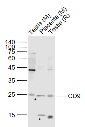 Lane 1: Mouse Testis lysates; Lane 2: Mouse Placenta lysates; Lane 3: Rat Testis lysates probed with CD9/MRP-1 Polyclonal Antibody, Unconjugated (bs-2489R) at 1:1000 dilution and 4˚C overnight incubation. Followed by conjugated secondary antibody incubation at 1:20000 for 60 min at 37˚C.