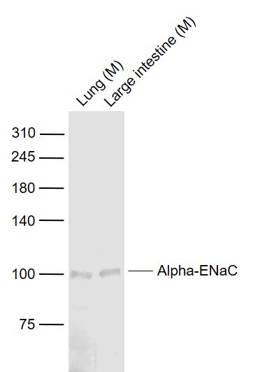 Lane 1: Mouse Lung lysates; Lane 2: Mouse Large intestine lysates probed with Alpha-ENaC Polyclonal Antibody, Unconjugated (bs-2957R) at 1:1000 dilution and 4˚C overnight incubation. Followed by conjugated secondary antibody incubation at 1:20000 for 60 min at 37˚C.