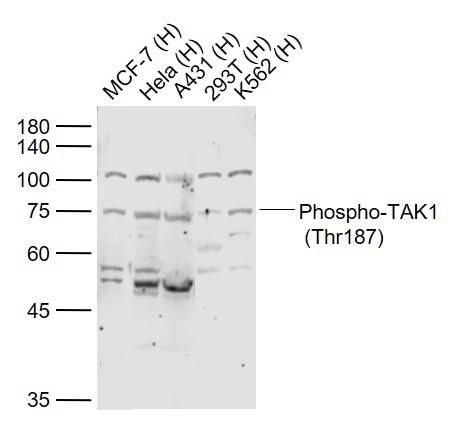 Lane 1: Human MCF-7 cell lysates; Lane 2: Human Hela cell lysates; Lane 3: Human A431 cell lysates; Lane 4: Human 293T cell lysates; Lane 5: Human K562 cell lysates probed with TAK1 Polyclonal Antibody, Unconjugated (bs-3438R) at 1:1000 dilution and 4˚C overnight incubation. Followed by conjugated secondary antibody incubation at 1:20000 for 60 min at 37˚C.