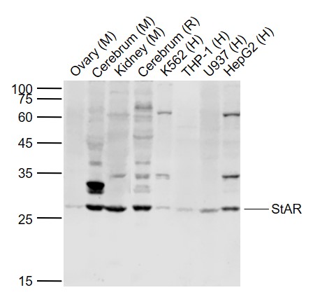 Lane 1: Mouse Ovary lysates; Lane 2: Mouse Cerebrum lysates; Lane 3: Mouse Kidney lysates; Lane 4: Rat Cerebrum lysates; Lane 5: Human K562cell lysates; Lane 6: Human THP-1 cell lysates; Lane 7: Human U937 cell lysates; Lane 8: Human HepG2 cell lysates probed with StAR Polyclonal Antibody, Unconjugated (bs-3570R) at 1:1000 dilution and 4˚C overnight incubation. Followed by conjugated secondary antibody incubation at 1:20000 for 60 min at 37˚C.