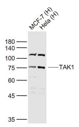 Lane 1: Human MCF-7 cell lysates; Lane 2: Human Hela cell lysates probed with TAK1 Polyclonal Antibody, Unconjugated (bs-3585R) at 1:1000 dilution and 4˚C overnight incubation. Followed by conjugated secondary antibody incubation at 1:20000 for 60 min at 37˚C.