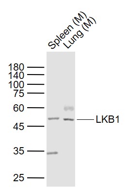 Lane 1: Mouse Spleen lysates; Lane 2: Mouse Lung lysates probed with LKB1 Polyclonal Antibody, Unconjugated (bs-3948R) at 1:1000 dilution and 4˚C overnight incubation. Followed by conjugated secondary antibody incubation at 1:20000 for 60 min at 37˚C.