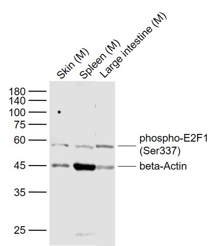 Lane 1: Mouse Skin lysates; Lane 2: Mouse Spleen lysates; Lane 3: Mouse Large intestine lysates probed with E2F1 Polyclonal Antibody, Unconjugated (bs-5305R) at 1:1000 dilution and 4˚C overnight incubation. Followed by conjugated secondary antibody incubation at 1:20000 for 60 min at 37˚C.