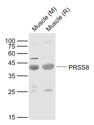 Lane 1: Mouse Muscle lysates; Lane 2: Rat Muscle lysates probed with PRSS8 Polyclonal Antibody, Unconjugated (bs-6064R) at 1:1000 dilution and 4˚C overnight incubation. Followed by conjugated secondary antibody incubation at 1:20000 for 60 min at 37˚C.
