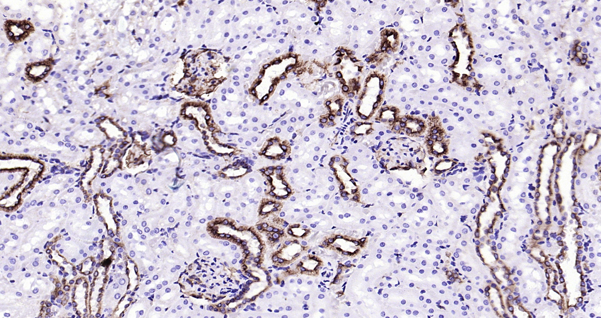 Paraformaldehyde-fixed, paraffin embedded Rat kidney; Antigen retrieval by boiling in sodium citrate buffer (pH6.0) for 15min; Block endogenous peroxidase by 3% hydrogen peroxide for 20 minutes; Blocking buffer (normal goat serum) at 37°C for 30min; Antibody incubation with Ephrin B2 (3A7) Monoclonal Antibody, Unconjugated (bsm-54090R) at 1:200 overnight at 4°C, DAB staining.