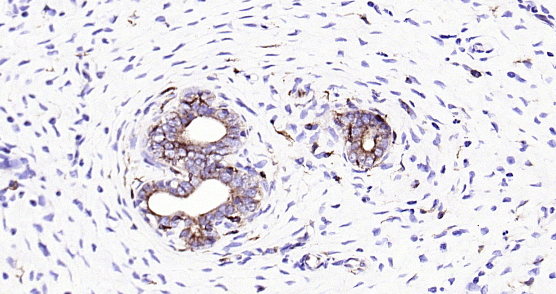 Paraformaldehyde-fixed, paraffin embedded Rat uterus; Antigen retrieval by boiling in sodium citrate buffer (pH6.0) for 15min; Block endogenous peroxidase by 3% hydrogen peroxide for 20 minutes; Blocking buffer (normal goat serum) at 37°C for 30min; Antibody incubation with Ephrin B2 (3A7) Monoclonal Antibody, Unconjugated (bsm-54090R) at 1:200 overnight at 4°C, DAB staining.