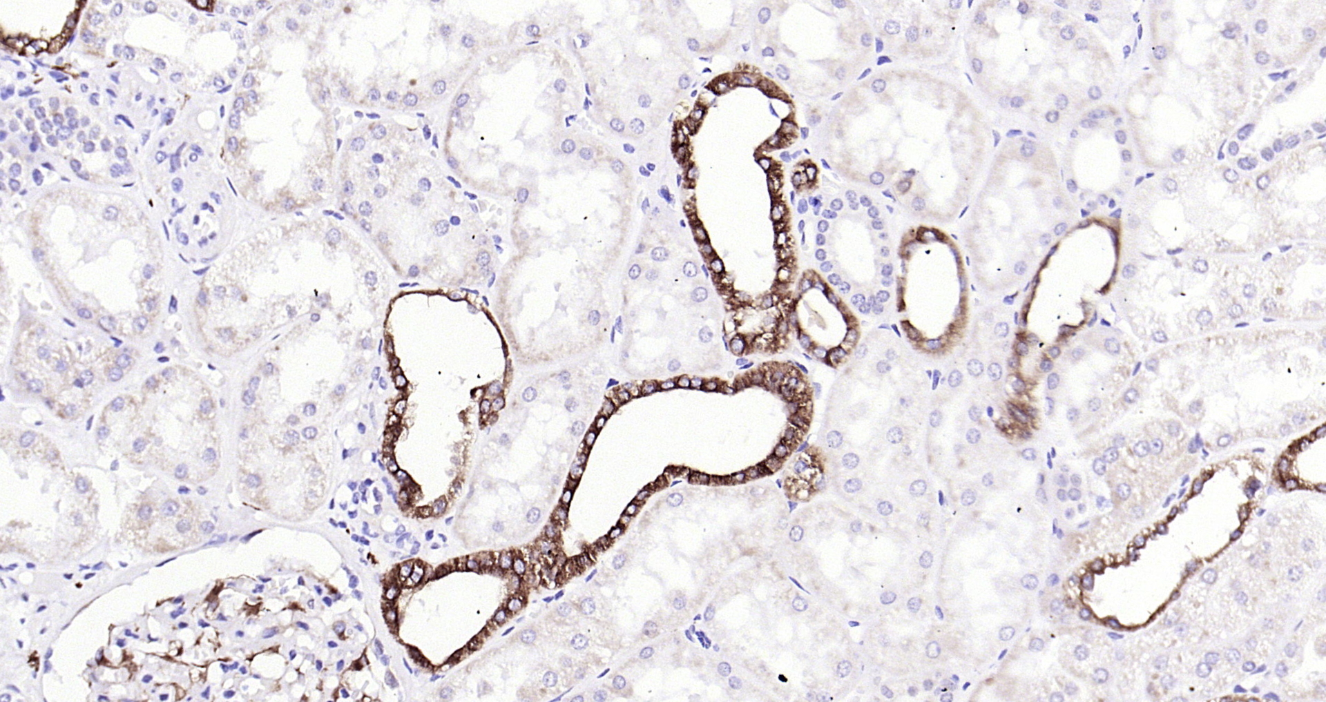 Paraformaldehyde-fixed, paraffin embedded Human kidney; Antigen retrieval by boiling in sodium citrate buffer (pH6.0) for 15min; Block endogenous peroxidase by 3% hydrogen peroxide for 20 minutes; Blocking buffer (normal goat serum) at 37°C for 30min; Antibody incubation with Ephrin B2 (3A7) Monoclonal Antibody, Unconjugated (bsm-54090R) at 1:200 overnight at 4°C, DAB staining.