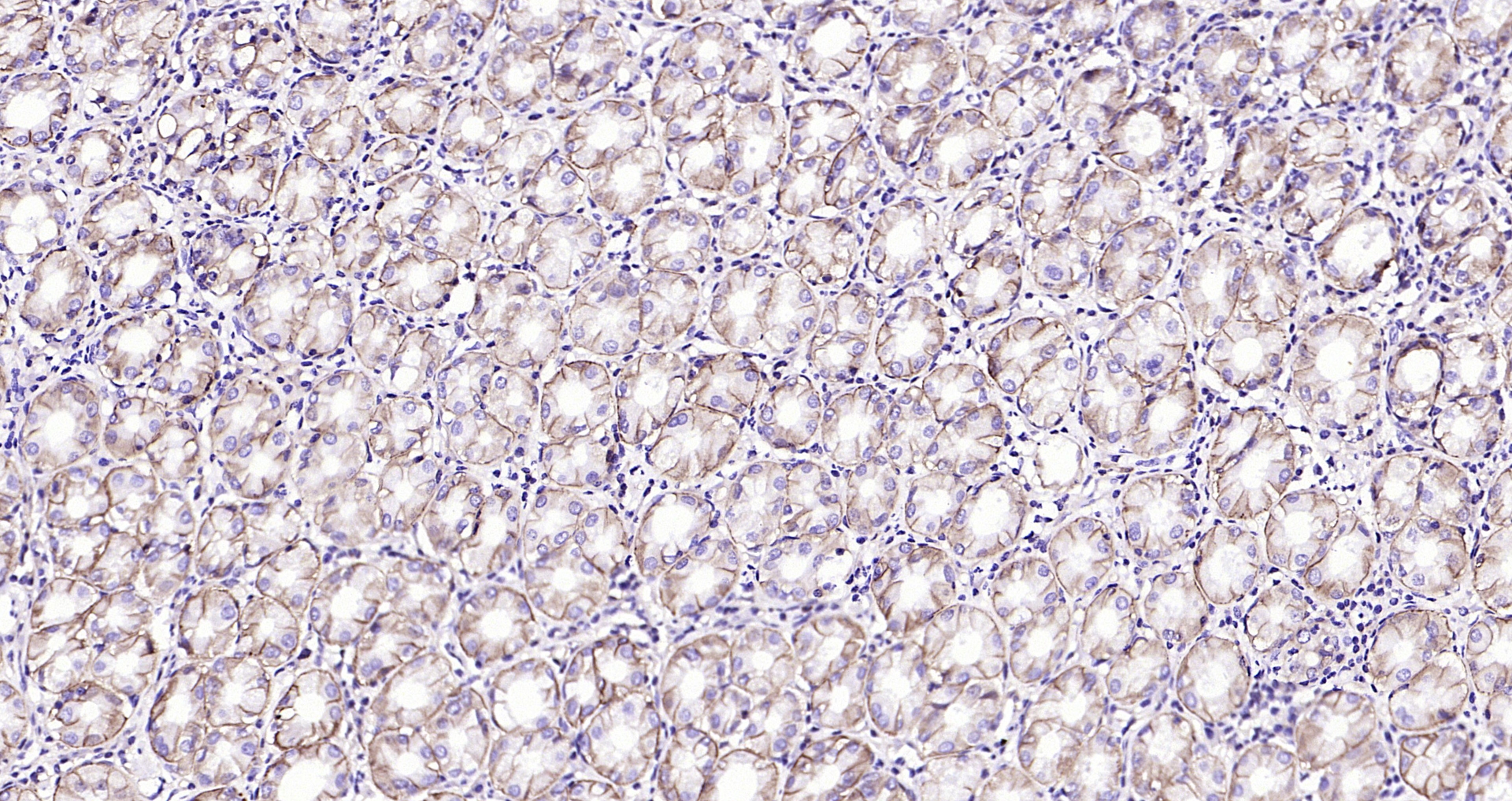 Paraformaldehyde-fixed, paraffin embedded Human stomach; Antigen retrieval by boiling in sodium citrate buffer (pH6.0) for 15min; Block endogenous peroxidase by 3% hydrogen peroxide for 20 minutes; Blocking buffer (normal goat serum) at 37°C for 30min; Antibody incubation with CD46 (4C3) Monoclonal Antibody, Unconjugated (bsm-54335R) at 1:200 overnight at 4°C, DAB staining.