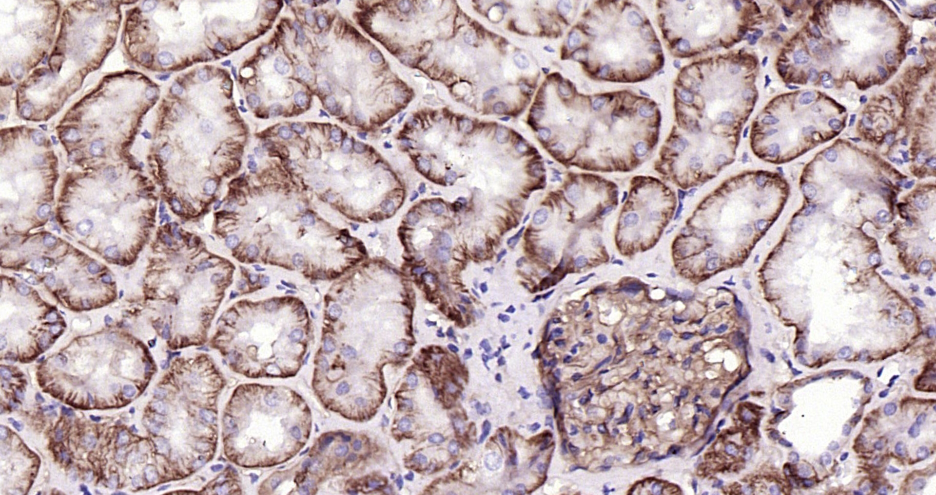 Paraformaldehyde-fixed, paraffin embedded Human kidney; Antigen retrieval by boiling in sodium citrate buffer (pH6.0) for 15min; Block endogenous peroxidase by 3% hydrogen peroxide for 20 minutes; Blocking buffer (normal goat serum) at 37°C for 30min; Antibody incubation with CD46 (4C3) Monoclonal Antibody, Unconjugated (bsm-54335R) at 1:200 overnight at 4°C, DAB staining.