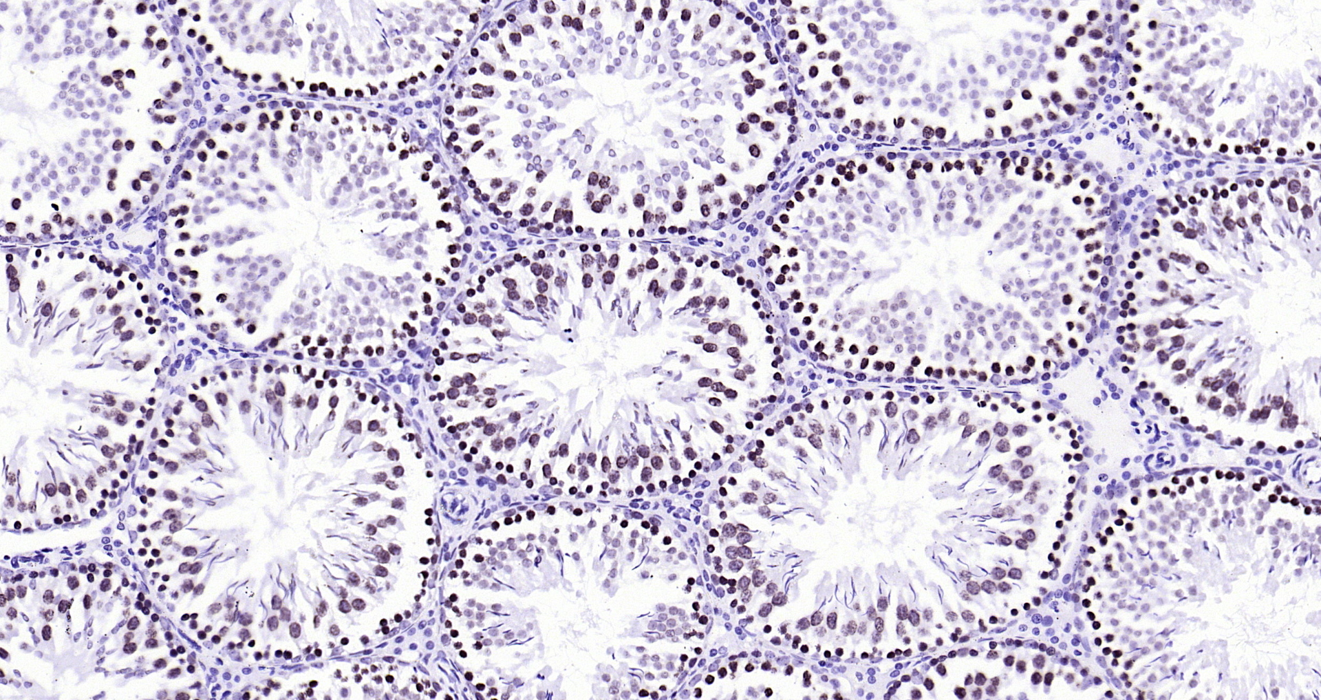 Paraformaldehyde-fixed, paraffin embedded Rat testis; Antigen retrieval by boiling in sodium citrate buffer (pH6.0) for 15min; Block endogenous peroxidase by 3% hydrogen peroxide for 20 minutes; Blocking buffer (normal goat serum) at 37°C for 30min; Antibody incubation with BANF1 (11H3) Monoclonal Antibody, Unconjugated (bsm-54435R) at 1:200 overnight at 4°C, DAB staining. Paraformaldehyde-fixed, paraffin embedded Rat testis; Antigen retrieval by boiling in sodium citrate buffer (pH6.0) for 15min; Block endogenous peroxidase by 3% hydrogen peroxide for 20 minutes; Blocking buffer (normal goat serum) at 37°C for 30min; Antibody incubation with BANF1 (11H3) Monoclonal Antibody, Unconjugated (bsm-54435R) at 1:200 overnight at 4°C, DAB staining.