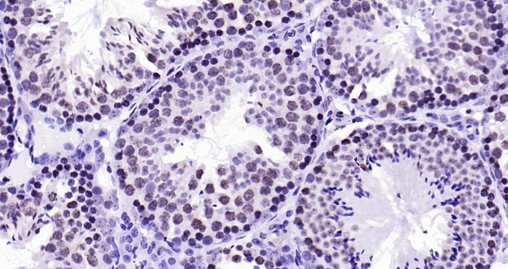 Paraformaldehyde-fixed, paraffin embedded Mouse testis; Antigen retrieval by boiling in sodium citrate buffer (pH6.0) for 15min; Block endogenous peroxidase by 3% hydrogen peroxide for 20 minutes; Blocking buffer (normal goat serum) at 37°C for 30min; Antibody incubation with BANF1 (11H3) Monoclonal Antibody, Unconjugated (bsm-54435R) at 1:200 overnight at 4°C, DAB staining. Paraformaldehyde-fixed, paraffin embedded Mouse testis; Antigen retrieval by boiling in sodium citrate buffer (pH6.0) for 15min; Block endogenous peroxidase by 3% hydrogen peroxide for 20 minutes; Blocking buffer (normal goat serum) at 37°C for 30min; Antibody incubation with BANF1 (11H3) Monoclonal Antibody, Unconjugated (bsm-54435R) at 1:200 overnight at 4°C, DAB staining.