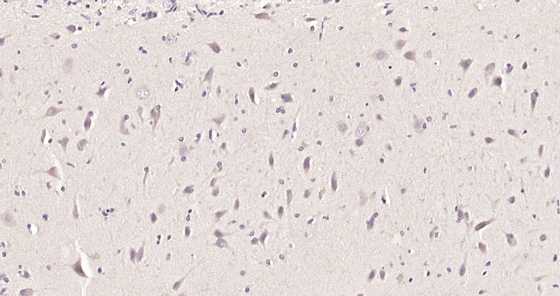 Paraformaldehyde-fixed, paraffin embedded Rat brain; Antigen retrieval by boiling in sodium citrate buffer (pH6.0) for 15min; Block endogenous peroxidase by 3% hydrogen peroxide for 20 minutes; Blocking buffer (normal goat serum) at 37°C for 30min; Antibody incubation with PACRG Polyclonal Antibody, Unconjugated (bs-9289R) at 1:200 overnight at 4°C, DAB staining.
