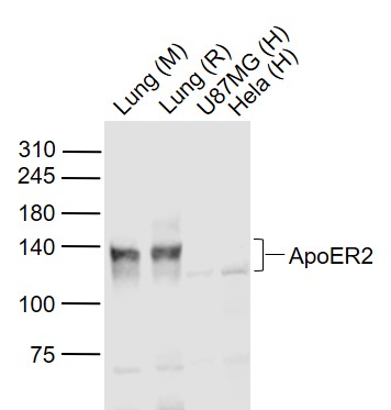 Lane 1: Mouse Lung lysates; Lane 2: Rat Lung lysates; Lane 3: Human U-87MG cell lysates; Lane 4: Human Hela cell lysates probed with ApoER2 Polyclonal Antibody, Unconjugated (bs-6651R) at 1:1000 dilution and 4˚C overnight incubation. Followed by conjugated secondary antibody incubation at 1:20000 for 60 min at 37˚C.
