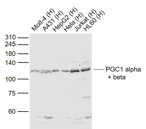 Lane 1: Human MOLT-4 cell lysates; Lane 2: Human A431 cell lysates; Lane 3: Human HepG2 cell lysates; Lane 4: Human Hela cell lysates; Lane 5: Human Jurkat cell lysates; Lane 6: Human HL-60 cell lysates probed with PGC1 alpha + beta Polyclonal Antibody, Unconjugated (bs-7535R) at 1:1000 dilution and 4˚C overnight incubation. Followed by conjugated secondary antibody incubation at 1:20000 for 60 min at 37˚C.