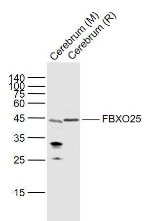 Lane 1: Mouse Cerebrum lysates; Lane 2: Rat Cerebrum lysates probed with FBXO25 Polyclonal Antibody, Unconjugated (bs-8491R) at 1:1000 dilution and 4˚C overnight incubation. Followed by conjugated secondary antibody incubation at 1:20000 for 60 min at 37˚C.