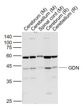 Lane 1: Mouse Cerebrum lysates; Lane 2: Mouse Cerebellum lysates; Lane 3: Mouse Spinal cord lysates; Lane 4: Rat Cerebrum lysates; Lane 5: Rat Cerebellum lysates probed with GDN Polyclonal Antibody, Unconjugated (bs-9845R) at 1:1000 dilution and 4˚C overnight incubation. Followed by conjugated secondary antibody incubation at 1:20000 for 60 min at 37˚C.