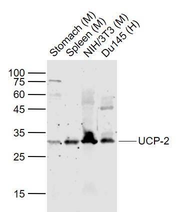 Lane 1: Mouse Stomach lysates; Lane 2: Mouse Spleen lysates; Lane 3: Mouse NIH/3T3 cell lysates; Lane 4: Hhuman DU145 cell lysates probed with UCP-2 Polyclonal Antibody, Unconjugated (bs-20750R) at 1:1000 dilution and 4˚C overnight incubation. Followed by conjugated secondary antibody incubation at 1:20000 for 60 min at 37˚C.