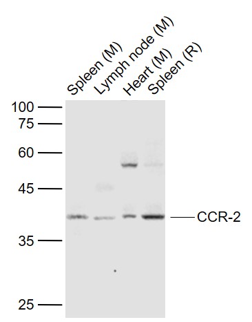 Lane 1: Mouse Spleen lysates; Lane 2: Mouse Lymph node lysates; Lane 3: Mouse Heart lysates; Lane 4: Rat Spleen lysates probed with CCR2 Polyclonal Antibody, Unconjugated (bs-23026R) at 1:1000 dilution and 4˚C overnight incubation. Followed by conjugated secondary antibody incubation at 1:20000 for 60 min at 37˚C.