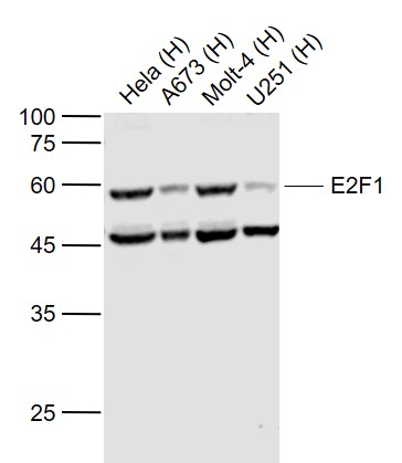 Lane 1: Human Hela cell lysates; Lane 2: Human A673 cell lysates; Lane 3: Human MOLT-4 cell lysates; Lane 4: Human U251 cell lysates probed with E2F1 Polyclonal Antibody, Unconjugated (bs-23185R) at 1:1000 dilution and 4˚C overnight incubation. Followed by conjugated secondary antibody incubation at 1:20000 for 60 min at 37˚C.