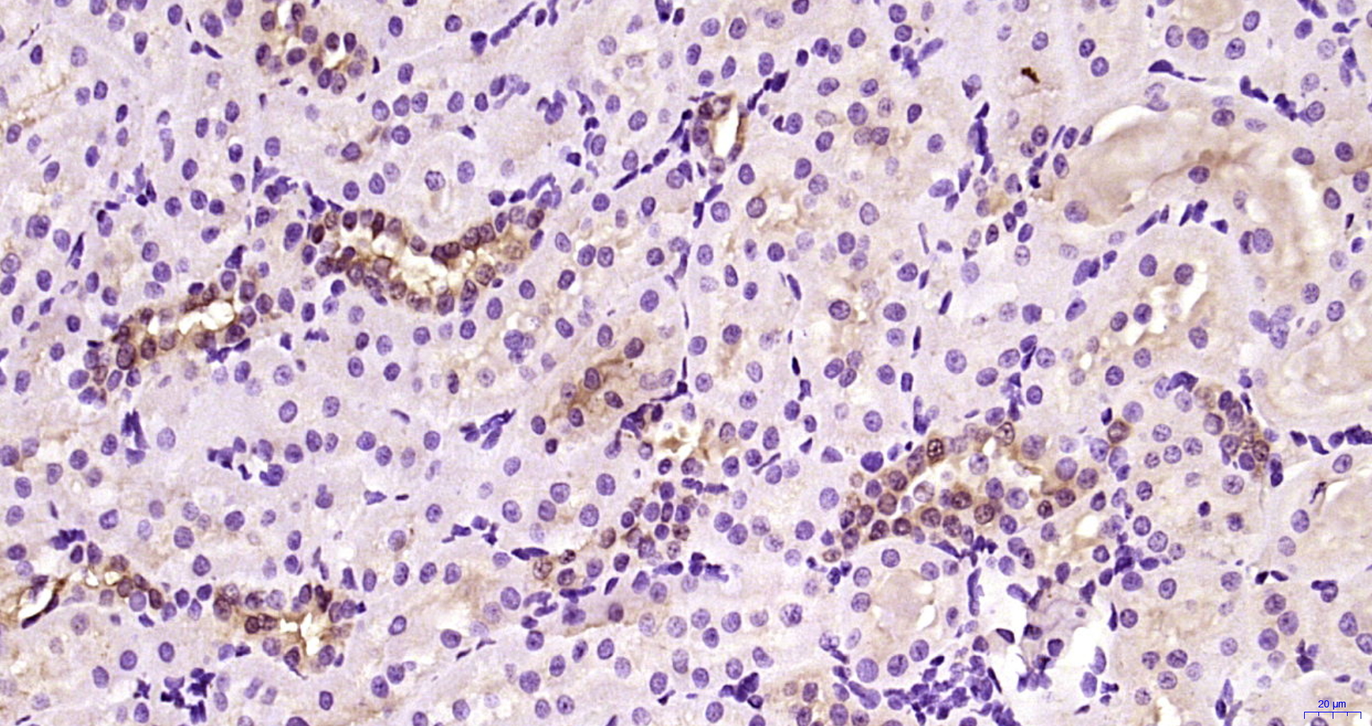 Paraformaldehyde-fixed, paraffin embedded Rat kidney; Antigen retrieval by boiling in sodium citrate buffer (pH6.0) for 15min; Block endogenous peroxidase by 3% hydrogen peroxide for 20 minutes; Blocking buffer (normal goat serum) at 37°C for 30min; Antibody incubation with NNF1R Polyclonal Antibody, Unconjugated (bs-9319R) at 1:200 overnight at 4°C, DAB staining.