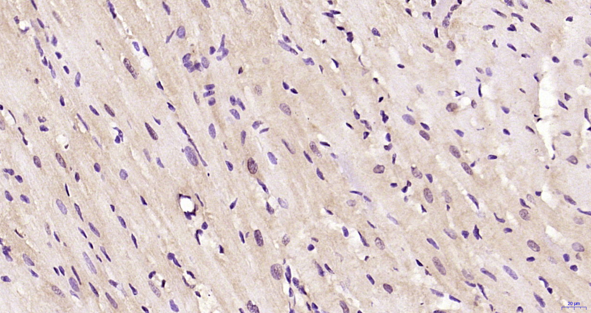 Paraformaldehyde-fixed, paraffin embedded Rat heart; Antigen retrieval by boiling in sodium citrate buffer (pH6.0) for 15min; Block endogenous peroxidase by 3% hydrogen peroxide for 20 minutes; Blocking buffer (normal goat serum) at 37°C for 30min; Antibody incubation with NNF1R Polyclonal Antibody, Unconjugated (bs-9319R) at 1:200 overnight at 4°C, DAB staining.