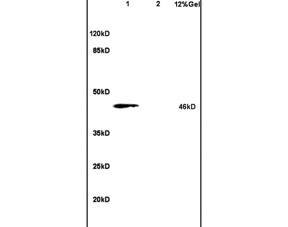 L1 rat brain lysates L2 human colon carcinoma lysates probed with Anti PHKG2 Polyclonal Antibody, Unconjugated (bs-5010R) at 1:200 in 4˚C. Followed by conjugation to secondary antibody (bs-0295G-HRP) at 1:3000 90min in 37˚C. Predicted band 46kD. Observed band size: 46kD