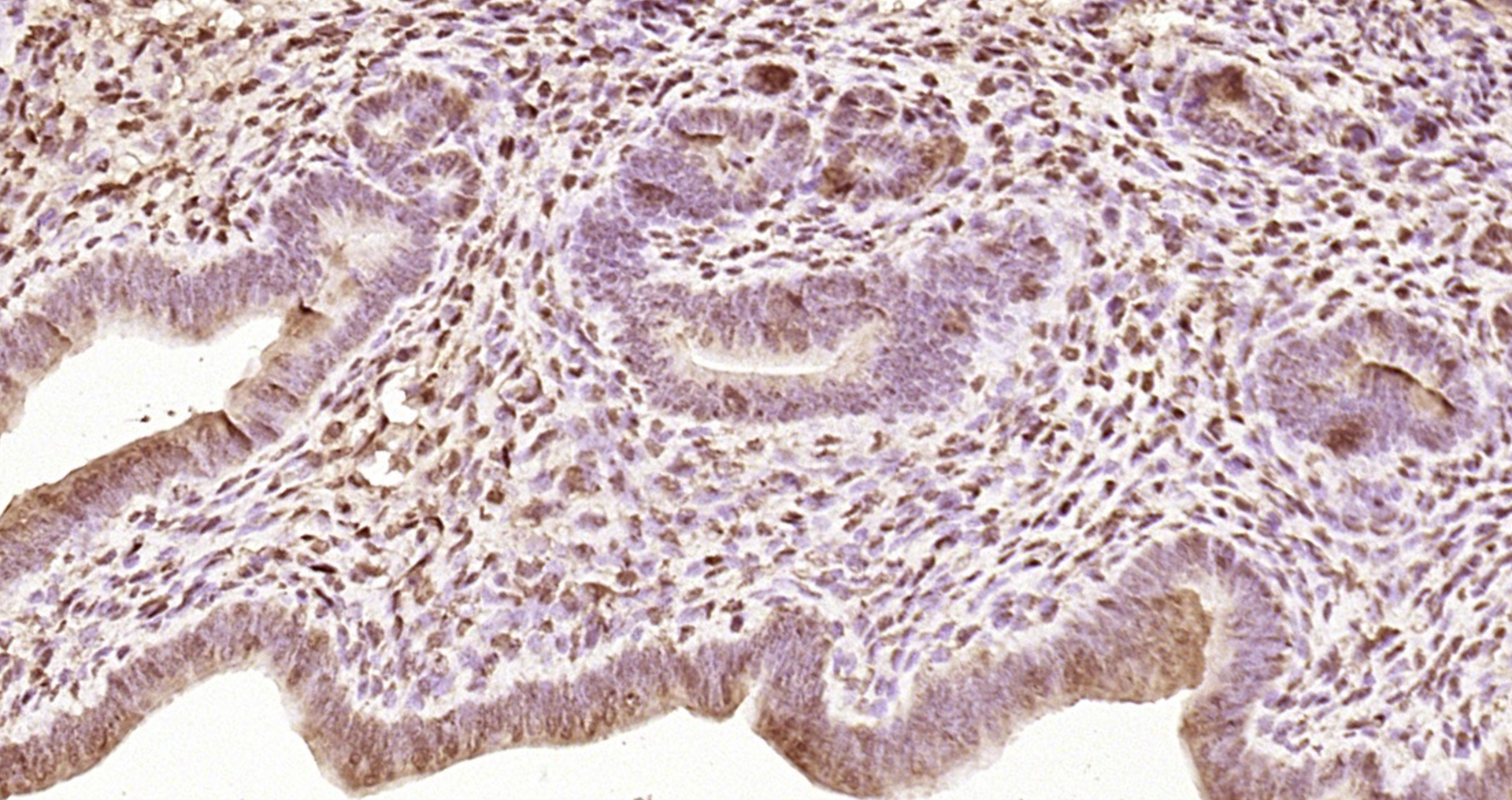 Paraformaldehyde-fixed, paraffin embedded Mouse uterus; Antigen retrieval by boiling in sodium citrate buffer (pH6.0) for 15min; Block endogenous peroxidase by 3% hydrogen peroxide for 20 minutes; Blocking buffer (normal goat serum) at 37°C for 30min; Antibody incubation with FAM76A Polyclonal Antibody, Unconjugated (bs-9658R) at 1:200 overnight at 4°C, DAB staining. Paraformaldehyde-fixed, paraffin embedded Mouse uterus; Antigen retrieval by boiling in sodium citrate buffer (pH6.0) for 15min; Block endogenous peroxidase by 3% hydrogen peroxide for 20 minutes; Blocking buffer (normal goat serum) at 37°C for 30min; Antibody incubation with FAM76A Polyclonal Antibody, Unconjugated (bs-9658R) at 1:200 overnight at 4°C, DAB staining.