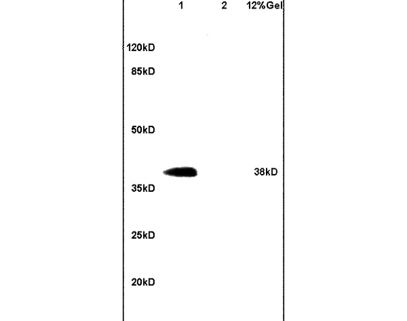 L1 mouse heart lysates L2 mouse brain lysates probed with Anti DNAJB4/HSP40 homolog Polyclonal Antibody, Unconjugated (bs-6002R) at 1:200 in 4˚C. Followed by conjugation to secondary antibody (bs-0295G-HRP) at 1:3000 90min in 37˚C. Predicted band 38kD. Observed band size: 38kD