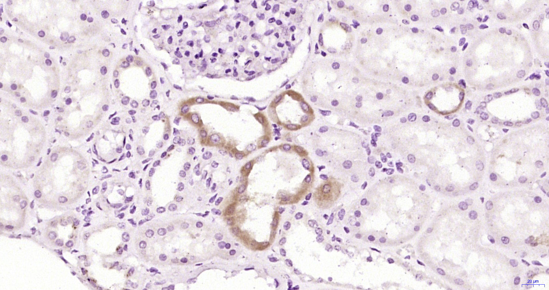 Paraformaldehyde-fixed, paraffin embedded Human kidney; Antigen retrieval by boiling in sodium citrate buffer (pH6.0) for 15min; Block endogenous peroxidase by 3% hydrogen peroxide for 20 minutes; Blocking buffer (normal goat serum) at 37°C for 30min; Antibody incubation with Endothelial Lipase Polyclonal Antibody, Unconjugated (bs-10188R) at 1:200 overnight at 4°C, DAB staining.