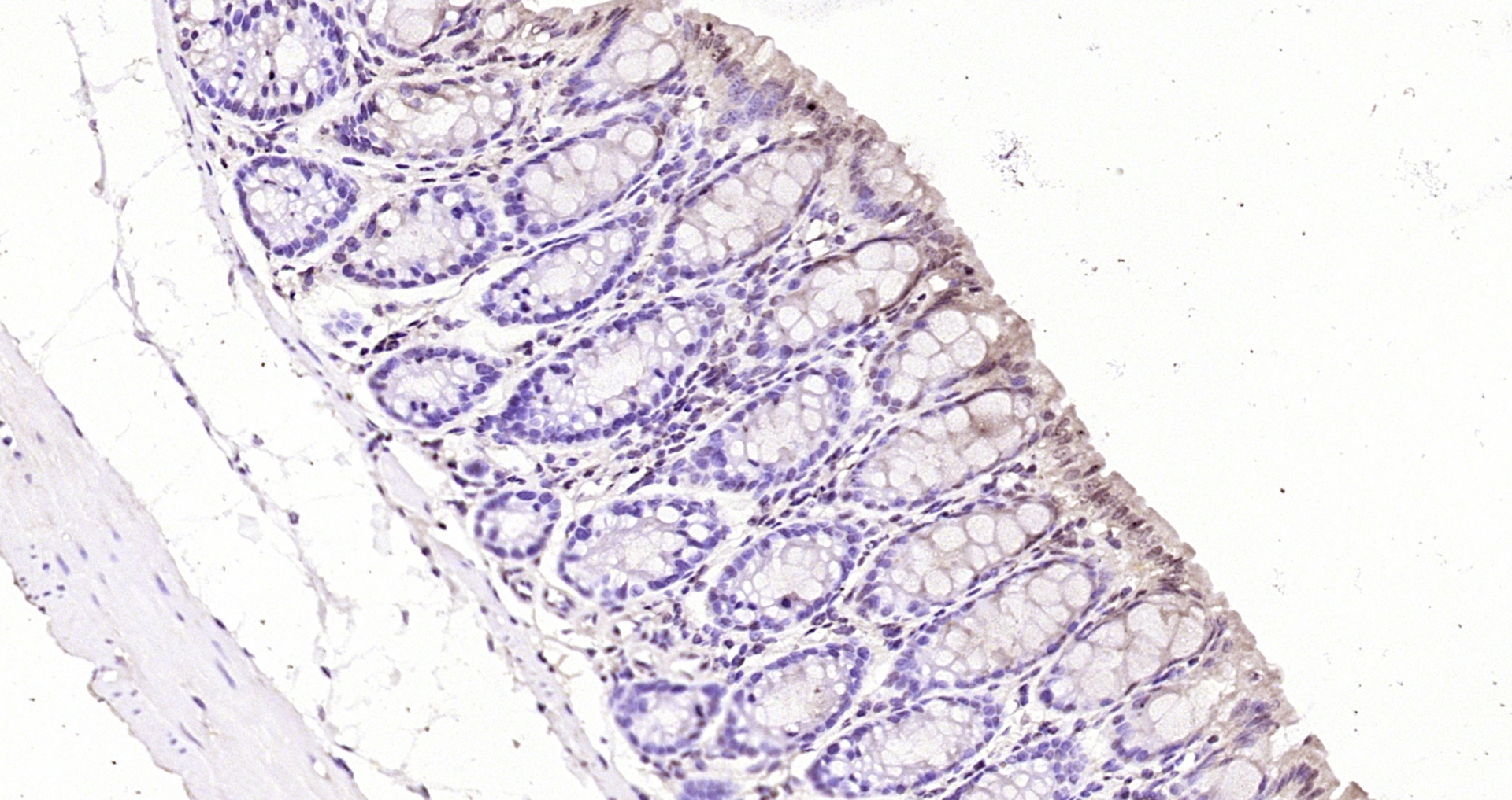 Paraformaldehyde-fixed, paraffin embedded Mouse colon; Antigen retrieval by boiling in sodium citrate buffer (pH6.0) for 15min; Block endogenous peroxidase by 3% hydrogen peroxide for 20 minutes; Blocking buffer (normal goat serum) at 37°C for 30min; Antibody incubation with HINT1 Polyclonal Antibody, Unconjugated (bs-10228R) at 1:200 overnight at 4°C, DAB staining. Paraformaldehyde-fixed, paraffin embedded Mouse colon; Antigen retrieval by boiling in sodium citrate buffer (pH6.0) for 15min; Block endogenous peroxidase by 3% hydrogen peroxide for 20 minutes; Blocking buffer (normal goat serum) at 37°C for 30min; Antibody incubation with HINT1 Polyclonal Antibody, Unconjugated (bs-10228R) at 1:200 overnight at 4°C, DAB staining.