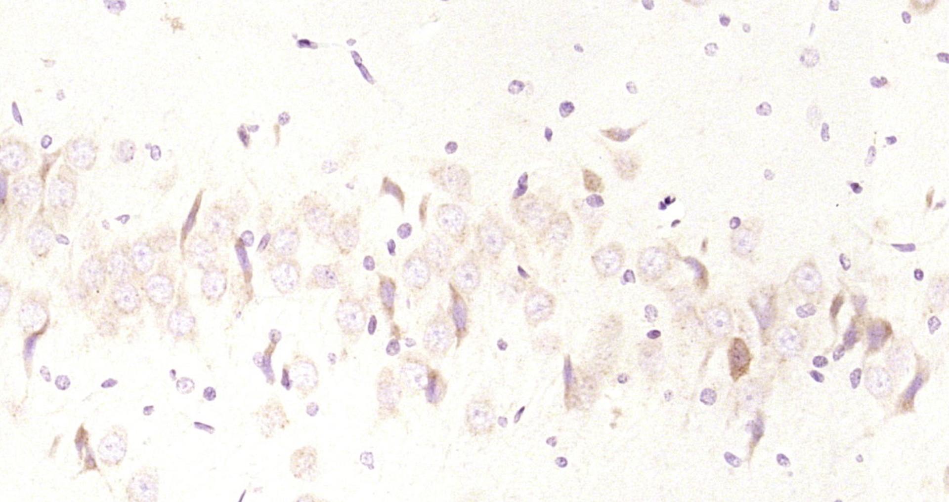 Paraformaldehyde-fixed, paraffin embedded Rat brain; Antigen retrieval by boiling in sodium citrate buffer (pH6.0) for 15min; Block endogenous peroxidase by 3% hydrogen peroxide for 20 minutes; Blocking buffer (normal goat serum) at 37°C for 30min; Antibody incubation with WASF3 Polyclonal Antibody, Unconjugated (bs-10578) at 1:200 overnight at 4°C, DAB staining.