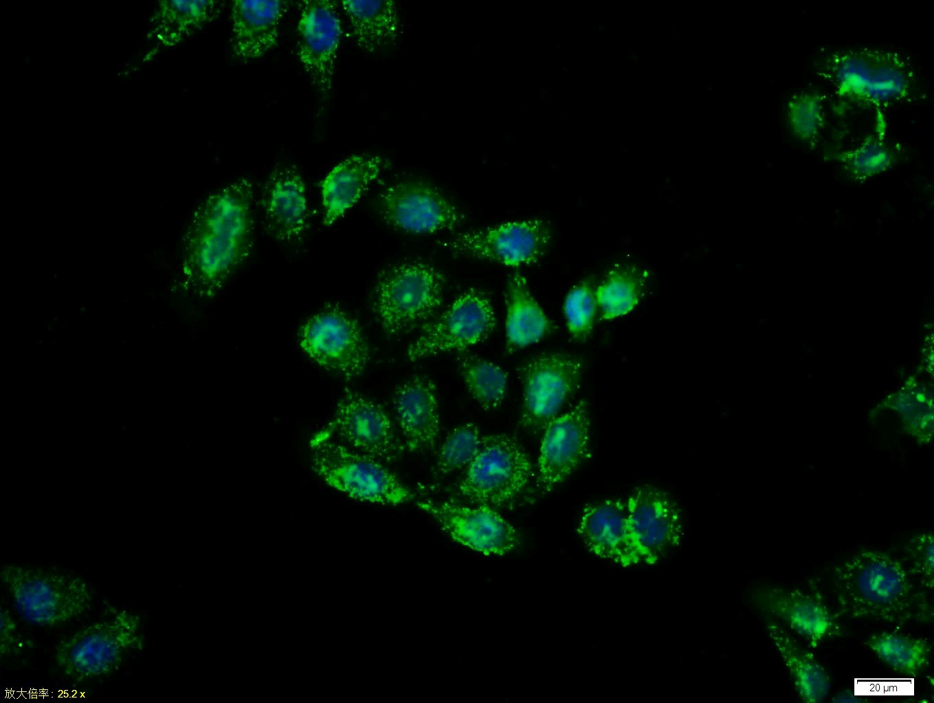 Tissue/cell:MCF7 cell; 4% Paraformaldehyde-fixed; Triton X-100 at room temperature for 20 min; Blocking buffer (normal goat serum, C-0005) at 37°C for 20 min; Antibody incubation with (Cytokeratin 19) polyclonal Antibody, Unconjugated (bs-2190R) 1:100, 90 minutes at 37°C; followed by a FITC conjugated Goat Anti-Rabbit IgG antibody at 37°C for 90 minutes, DAPI (blue, C02-04002) was used to stain the cell nuclei.