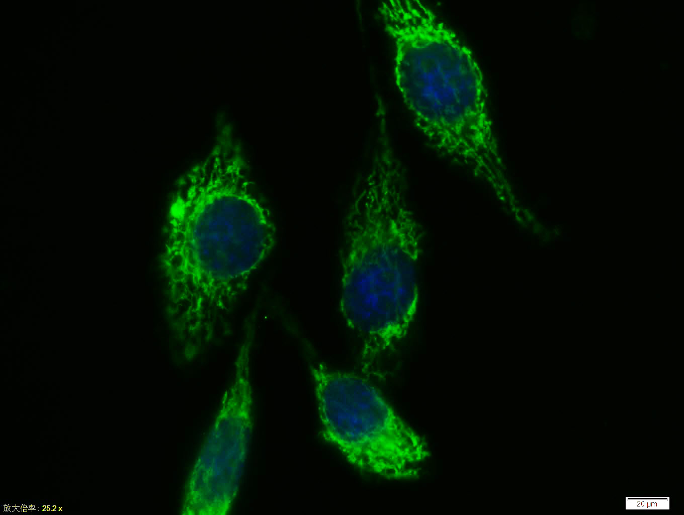 Tissue/cell:MCF7 cell; 4% Paraformaldehyde-fixed; Triton X-100 at room temperature for 20 min; Blocking buffer (normal goat serum, C-0005) at 37°C for 20 min; Antibody incubation with (CK19) polyclonal Antibody, Unconjugated (bs-15590R) 1:100, 90 minutes at 37°C; followed by a FITC conjugated Goat Anti-Rabbit IgG antibody at 37°C for 90 minutes, DAPI (blue, C02-04002) was used to stain the cell nuclei.