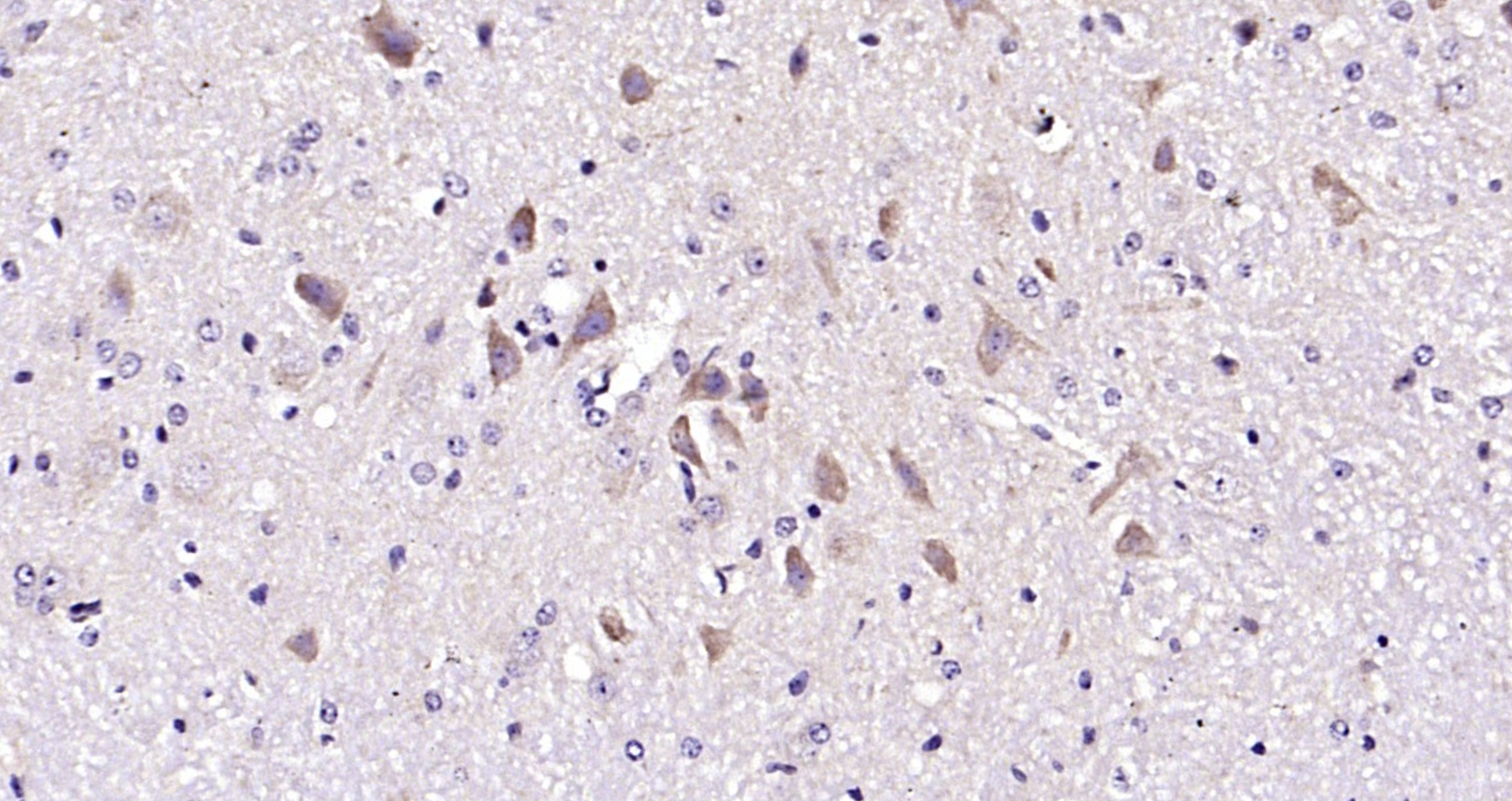 Paraformaldehyde-fixed, paraffin embedded Mouse cerebellum; Antigen retrieval by boiling in sodium citrate buffer (pH6.0) for 15min; Block endogenous peroxidase by 3% hydrogen peroxide for 20 minutes; Blocking buffer (normal goat serum) at 37°C for 30min; Antibody incubation with Noggin Polyclonal Antibody, Unconjugated (bs-2975R) at 1:200 overnight at 4°C, DAB staining.