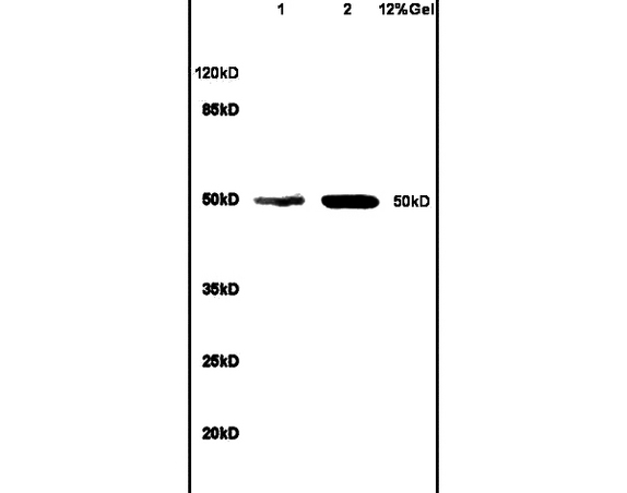 Lane 1: mouse brain lysates Lane 2: human colon carcinoma lysates probed with Anti-BCL3 Polyclonal Antibody, Unconjugated (bs-6591R) at 1:200 in 4C. Followed by conjugation to secondary antibody (bs-0295G-HRP) at 1:3000 90min in 37C. Predicted band 50kD. Observed band size: 50kD