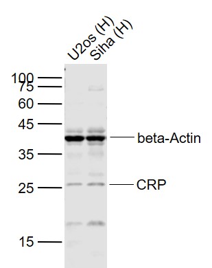 Lane 1: Human U-2OS cell lysates; Lane 2: Human Siha cell lysates probed with CRP(C11F2) Monoclonal Antibody, Unconjugated bsm-0391MR) at 1:1000 dilution and 4˚C overnight incubation. Followed by conjugated secondary antibody incubation at 1:20000 for 60 min at 37˚C.