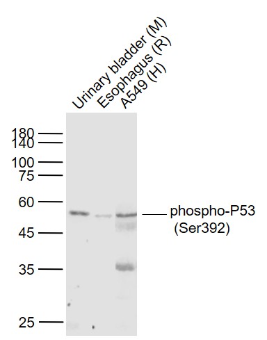 Lane 1: Mouse Urinary bladder lysates; Lane 2: Rat Esophagus lysates; Lane 3: Human A549 cell lysates probed with p53(S392) (3A1)  Monoclonal Antibody, Unconjugated (bsm-52182R) at 1:1000 dilution and 4˚C overnight incubation. Followed by conjugated secondary antibody incubation at 1:20000 for 60 min at 37˚C.