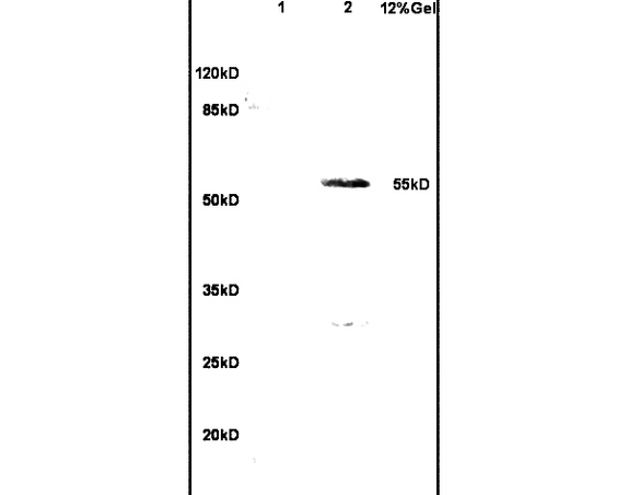 L1 human colon carcinoma lysates L2 rat brain lysates probed with Anti- WT-1/Wilms Tumor Protein Polyclonal Antibody, Unconjugated (bs-6983R) at 1:200 in 4˚C. Followed by conjugation to secondary antibody (bs-0295G-HRP) at 1:3000 90min in 37˚C. Predicted band 55kD. Observed band size: 55kD