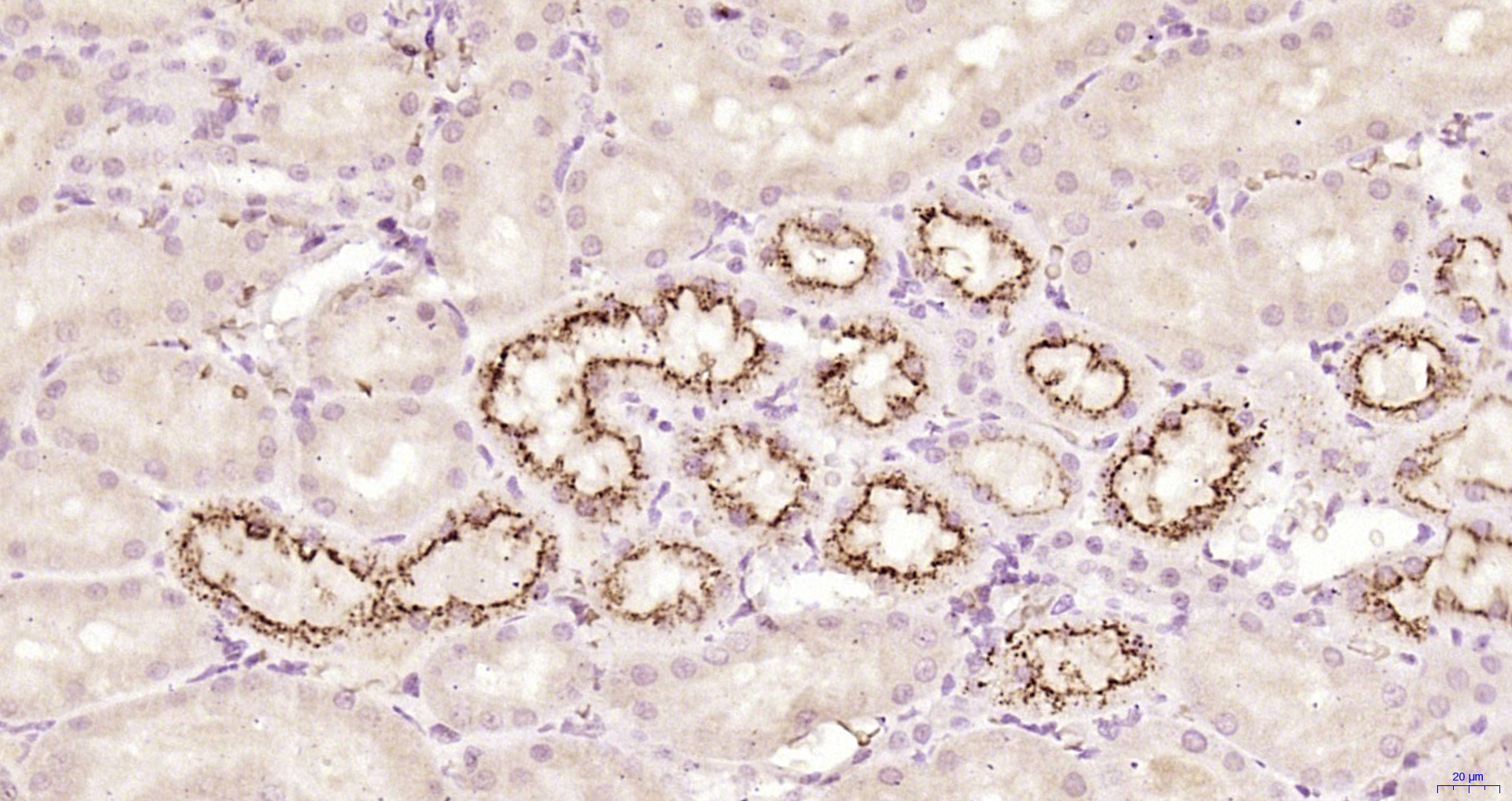 Paraformaldehyde-fixed, paraffin embedded Rat kidney; Antigen retrieval by boiling in sodium citrate buffer (pH6.0) for 15min; Block endogenous peroxidase by 3% hydrogen peroxide for 20 minutes; Blocking buffer (normal goat serum) at 37°C for 30min; Antibody incubation with Cystatin-C Polyclonal Antibody, Unconjugated (bs-10876R) at 1:200 overnight at 4°C, DAB staining.
