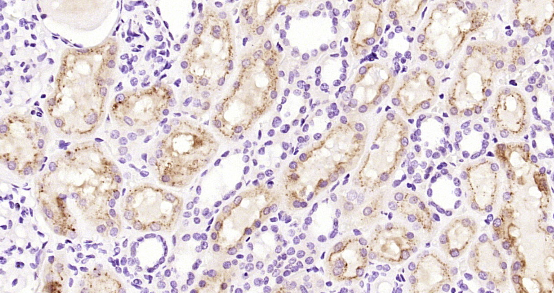 Paraformaldehyde-fixed, paraffin embedded Human kidney; Antigen retrieval by boiling in sodium citrate buffer (pH6.0) for 15min; Block endogenous peroxidase by 3% hydrogen peroxide for 20 minutes; Blocking buffer (normal goat serum) at 37°C for 30min; Antibody incubation with Cystatin-C Polyclonal Antibody, Unconjugated (bs-10876R) at 1:200 overnight at 4°C, DAB staining.
