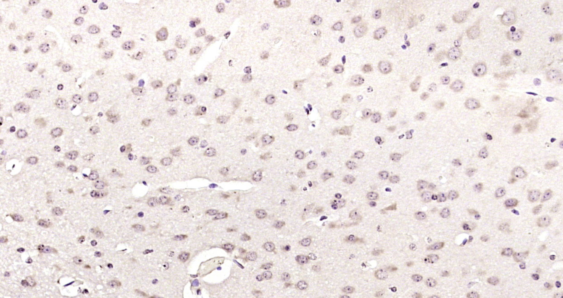 Paraformaldehyde-fixed, paraffin embedded Mouse brain; Antigen retrieval by boiling in sodium citrate buffer (pH6.0) for 15min; Block endogenous peroxidase by 3% hydrogen peroxide for 20 minutes; Blocking buffer (normal goat serum) at 37°C for 30min; Antibody incubation with RFC1 Polyclonal Antibody, Unconjugated (bs-11304R) at 1:200 overnight at 4°C, DAB staining.