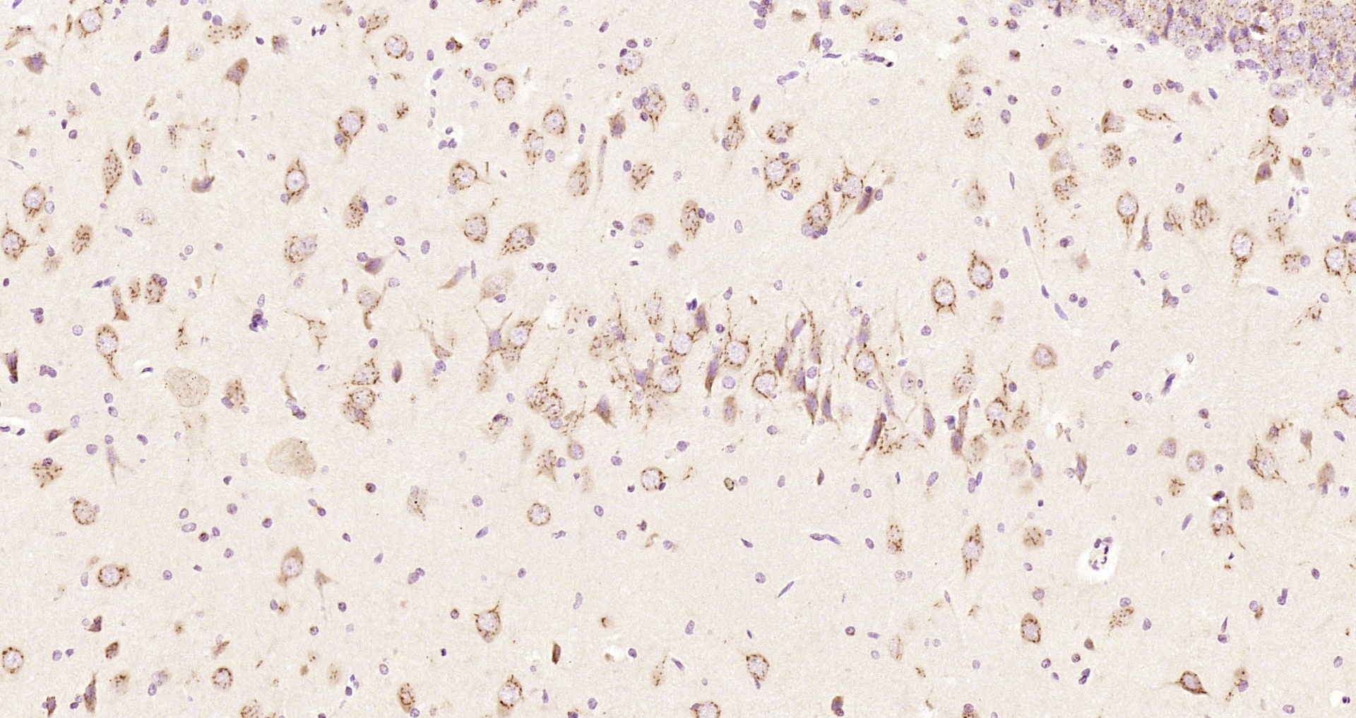 Paraformaldehyde-fixed, paraffin embedded Rat brain; Antigen retrieval by boiling in sodium citrate buffer (pH6.0) for 15min; Block endogenous peroxidase by 3% hydrogen peroxide for 20 minutes; Blocking buffer (normal goat serum) at 37°C for 30min; Antibody incubation with Synapsin 3 Polyclonal Antibody, Unconjugated (bs-11371R) at 1:200 overnight at 4°C, DAB staining.