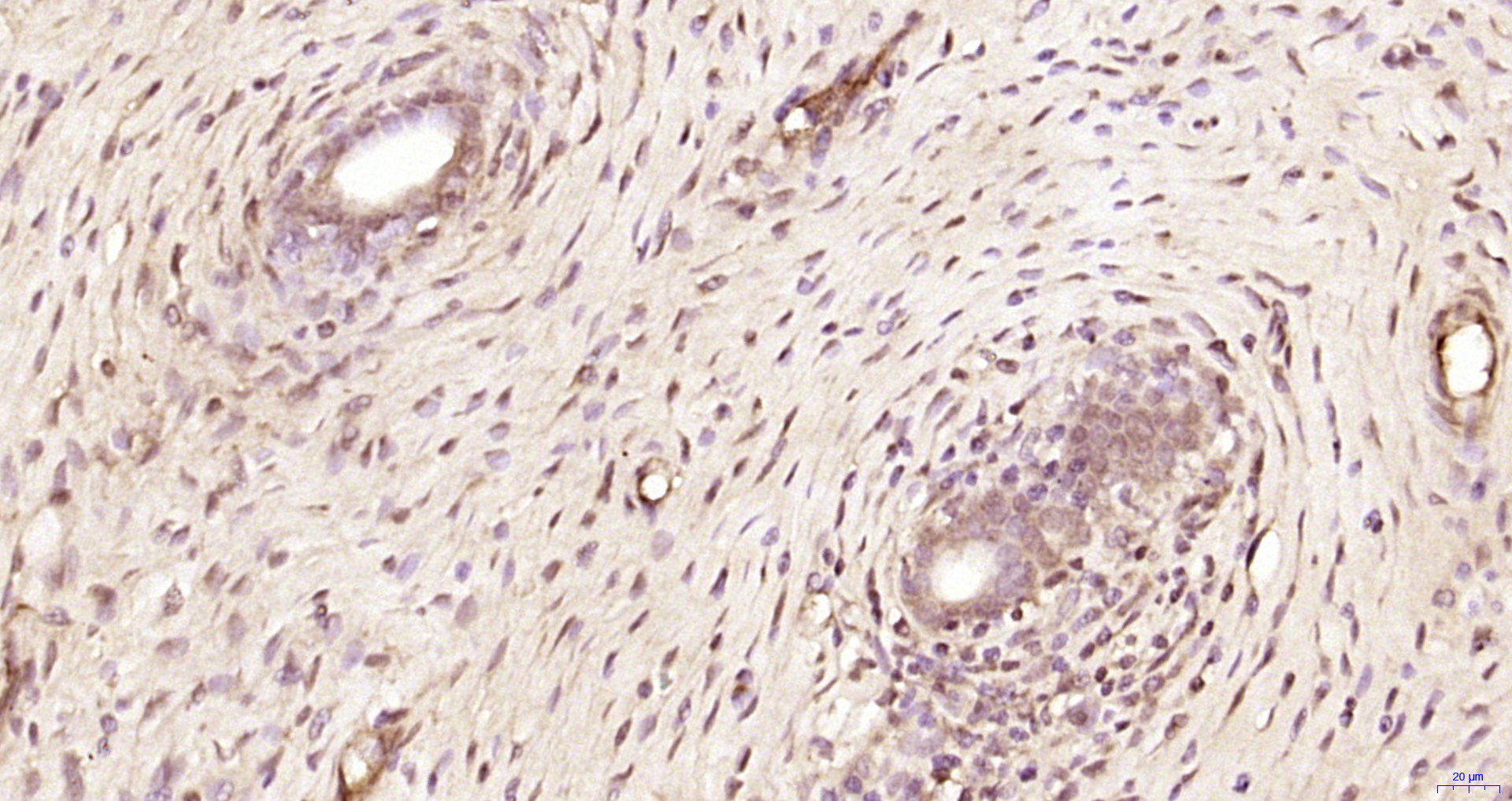 Paraformaldehyde-fixed, paraffin embedded Rat uterus; Antigen retrieval by boiling in sodium citrate buffer (pH6.0) for 15min; Block endogenous peroxidase by 3% hydrogen peroxide for 20 minutes; Blocking buffer (normal goat serum) at 37°C for 30min; Antibody incubation with ZNF318 Polyclonal Antibody, Unconjugated (bs-11414R) at 1:200 overnight at 4°C, DAB staining.