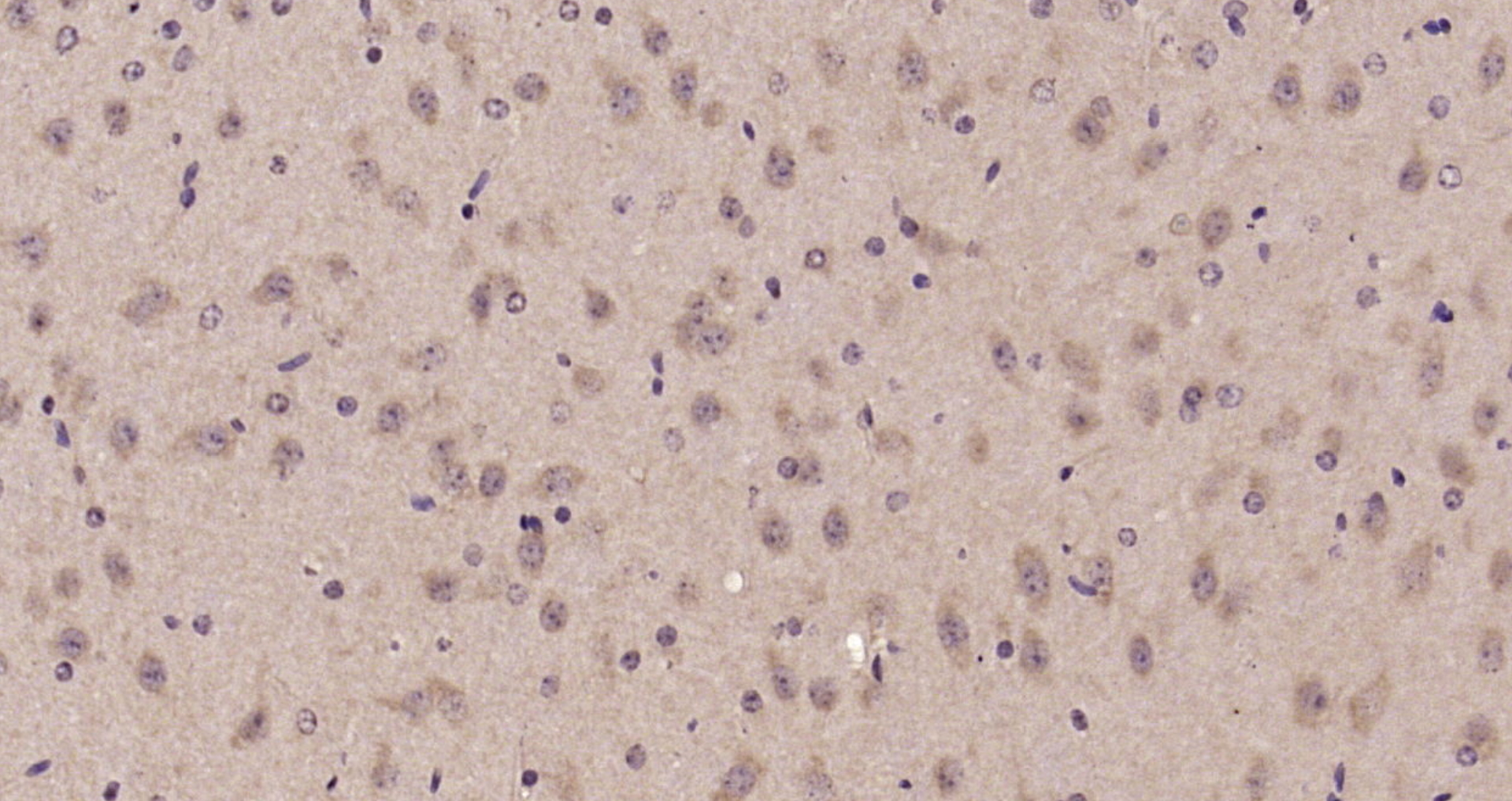 Paraformaldehyde-fixed, paraffin embedded Mouse brain; Antigen retrieval by boiling in sodium citrate buffer (pH6.0) for 15min; Block endogenous peroxidase by 3% hydrogen peroxide for 20 minutes; Blocking buffer (normal goat serum) at 37°C for 30min; Antibody incubation with Advillin Polyclonal Antibody, Unconjugated (bs-11451R) at 1:200 overnight at 4°C, DAB staining.