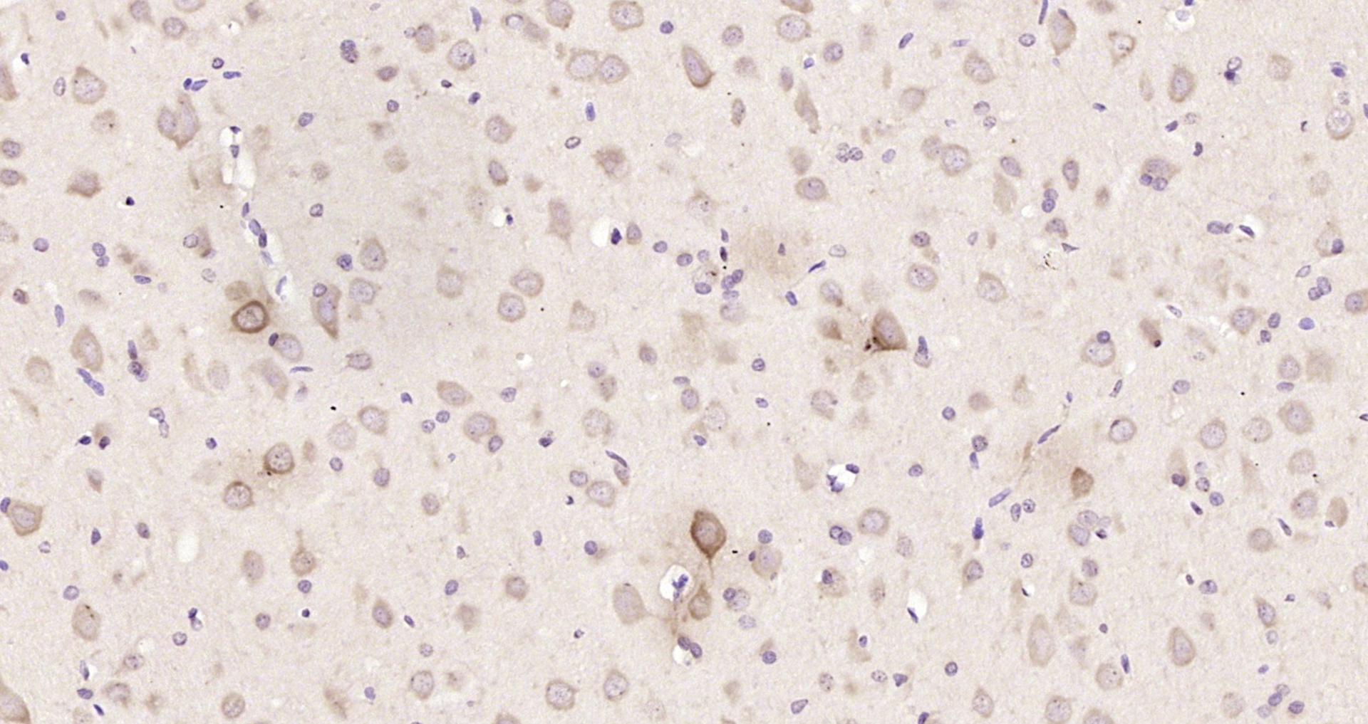 Paraformaldehyde-fixed, paraffin embedded Rat brain; Antigen retrieval by boiling in sodium citrate buffer (pH6.0) for 15min; Block endogenous peroxidase by 3% hydrogen peroxide for 20 minutes; Blocking buffer (normal goat serum) at 37°C for 30min; Antibody incubation with SORCS3 Polyclonal Antibody, Unconjugated (bs-11503R) at 1:200 overnight at 4°C, DAB staining.