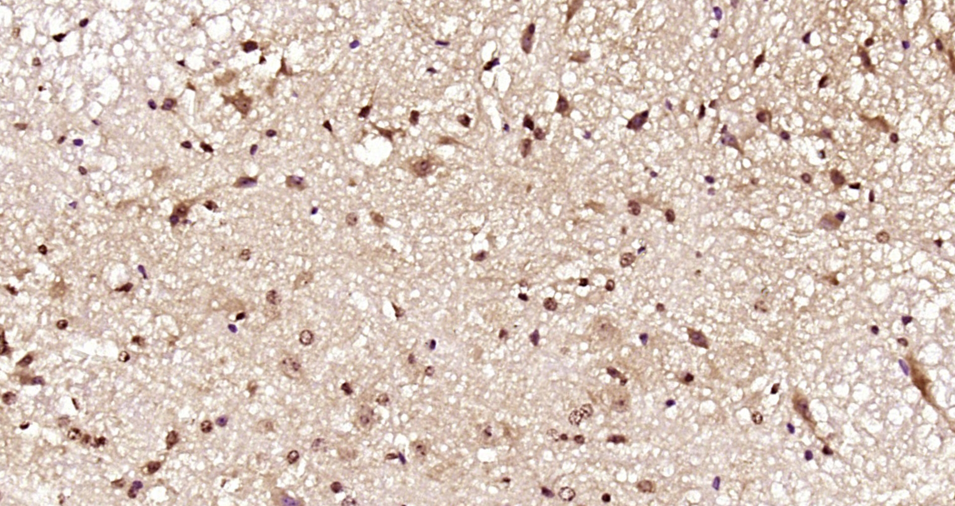 Paraformaldehyde-fixed, paraffin embedded Rat spinal cord; Antigen retrieval by boiling in sodium citrate buffer (pH6.0) for 15min; Block endogenous peroxidase by 3% hydrogen peroxide for 20 minutes; Blocking buffer (normal goat serum) at 37°C for 30min; Antibody incubation with Gemin 2/SMA Polyclonal Antibody, Unconjugated (bs-11562R) at 1:200 overnight at 4°C, DAB staining.