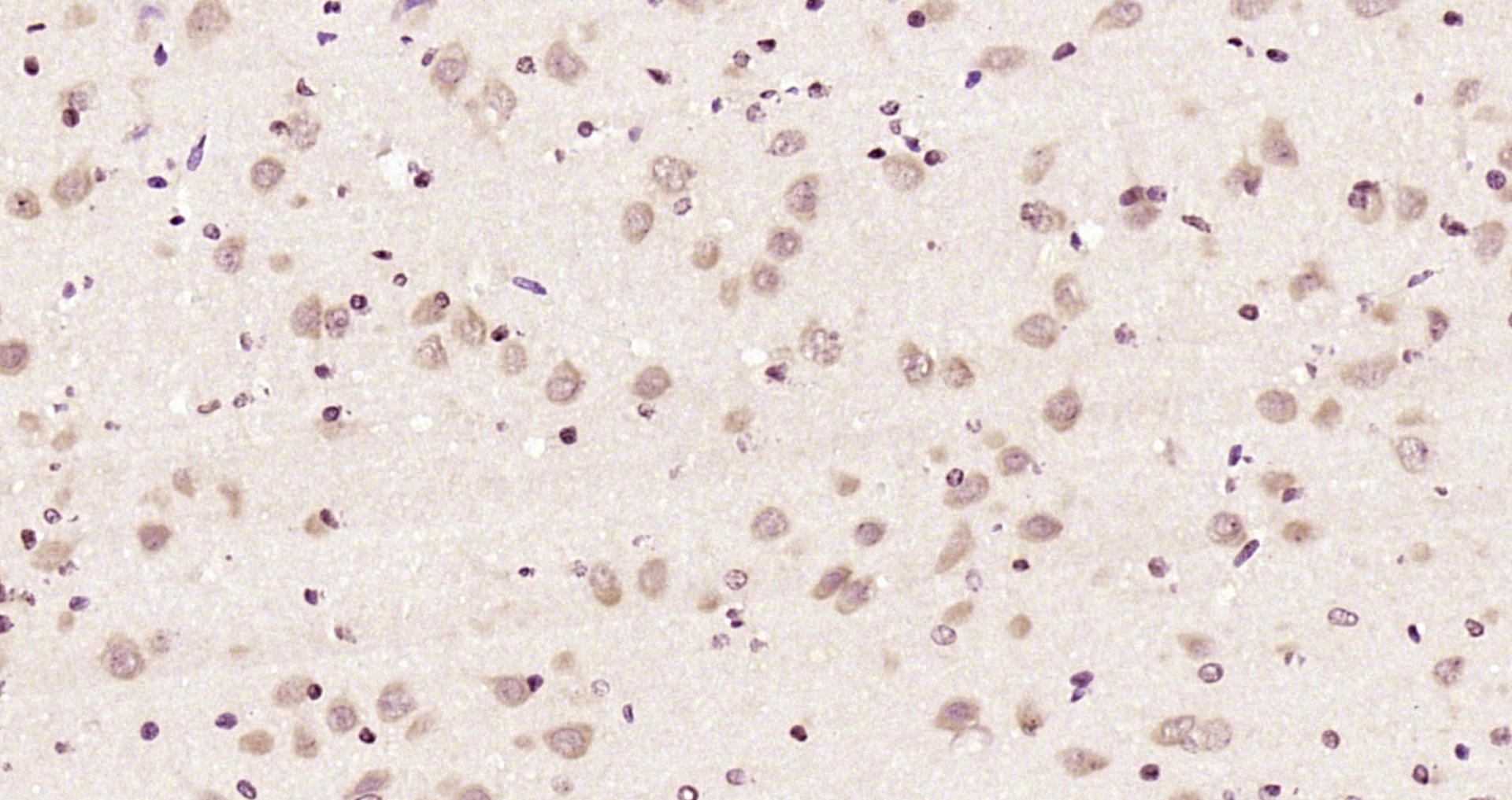 Paraformaldehyde-fixed, paraffin embedded Rat brain; Antigen retrieval by boiling in sodium citrate buffer (pH6.0) for 15min; Block endogenous peroxidase by 3% hydrogen peroxide for 20 minutes; Blocking buffer (normal goat serum) at 37°C for 30min; Antibody incubation with Gemin 2/SMA Polyclonal Antibody, Unconjugated (bs-11562R) at 1:200 overnight at 4°C, DAB staining.