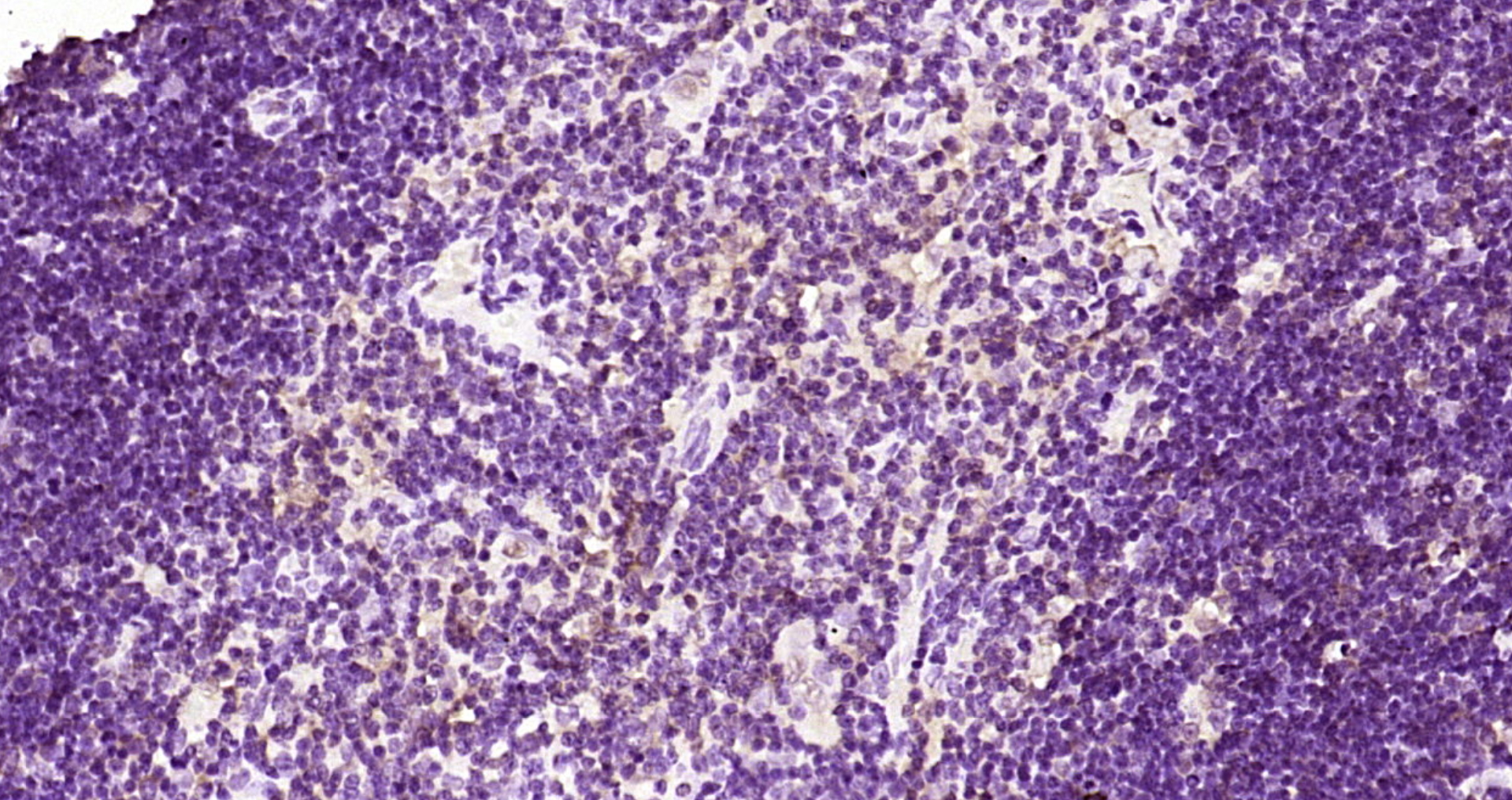 Paraformaldehyde-fixed, paraffin embedded Rat thymus; Antigen retrieval by boiling in sodium citrate buffer (pH6.0) for 15min; Block endogenous peroxidase by 3% hydrogen peroxide for 20 minutes; Blocking buffer (normal goat serum) at 37°C for 30min; Antibody incubation with Gemin 2/SMA Polyclonal Antibody, Unconjugated (bs-11562R) at 1:200 overnight at 4°C, DAB staining.